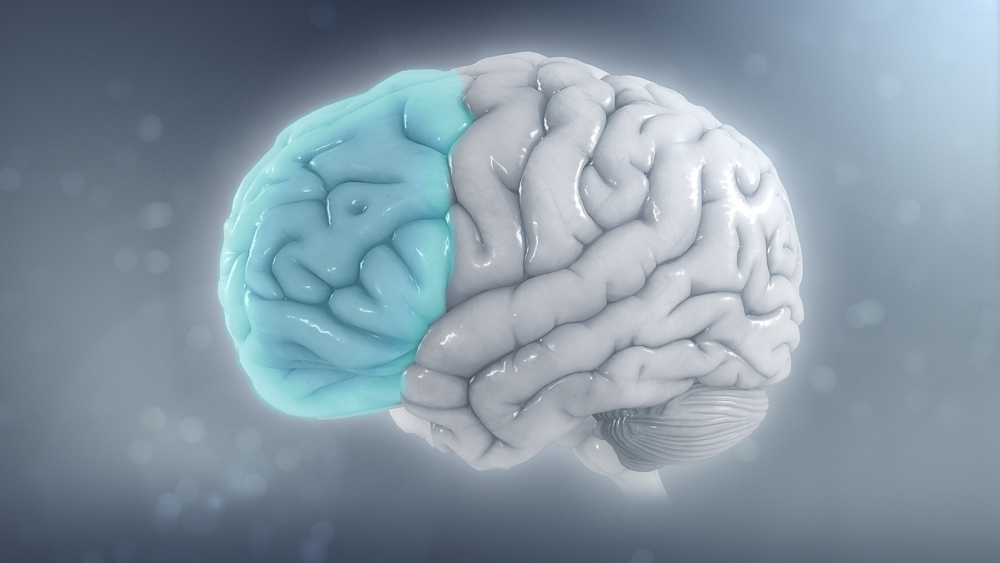 File:Attention deficit hyperactivity disorder - Attention deficit hyperactivity disorder - Reduced brain volume on the left side from ADHD.jpg